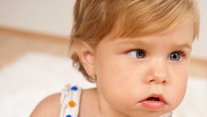علت انحراف چشم نوزادان