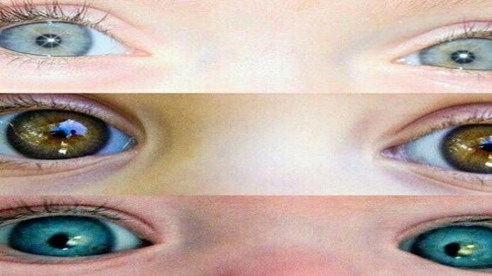 چه چیزی رنگ چشم جنین را تعیین می کند