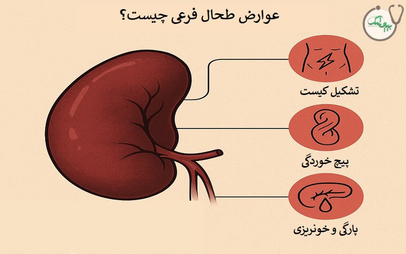 عوارض طحال فرعی