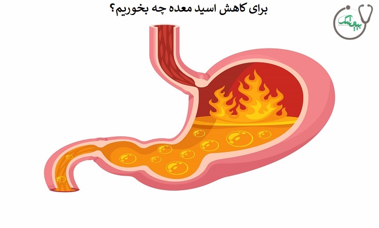 رژیم غذایی برای کاهش اسید معده