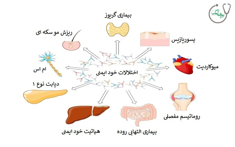 انواع بیماری خود ایمنی
