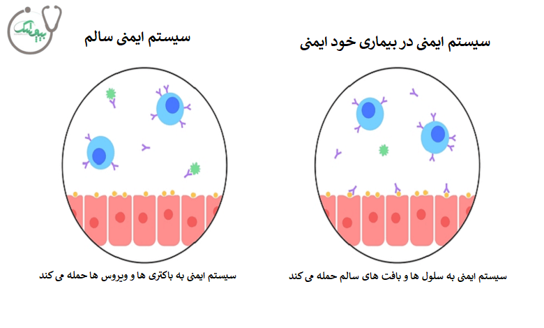 بیماری خود ایمنی