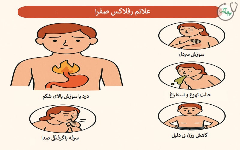 علائم رفلاکس صفرا
