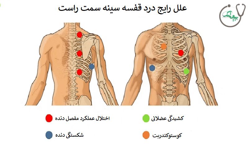  علت درد قفسه سینه سمت راست