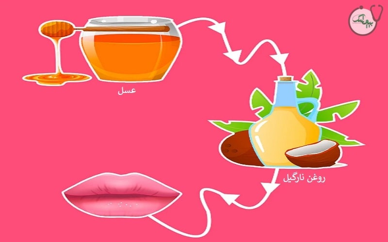 درمان خانگی ترک لب