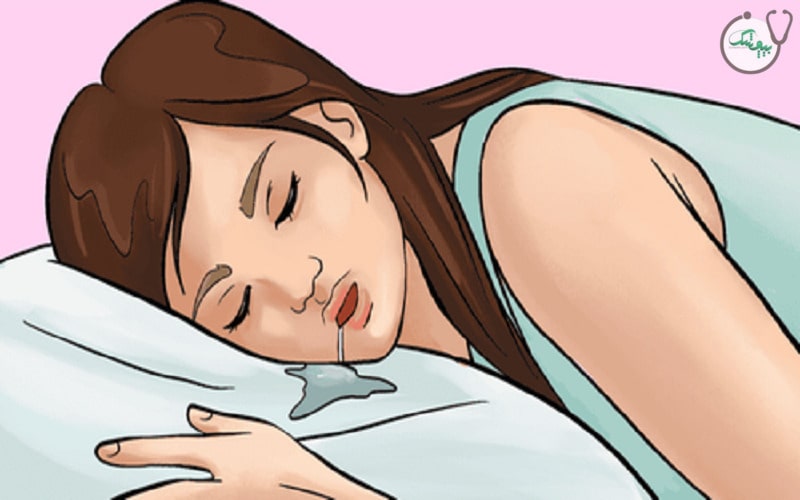 آبریزش دهان