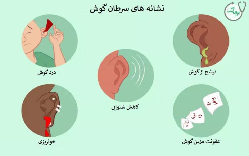 علائم سرطان گوش
