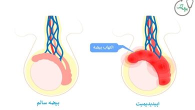 اپیدیدیمیت