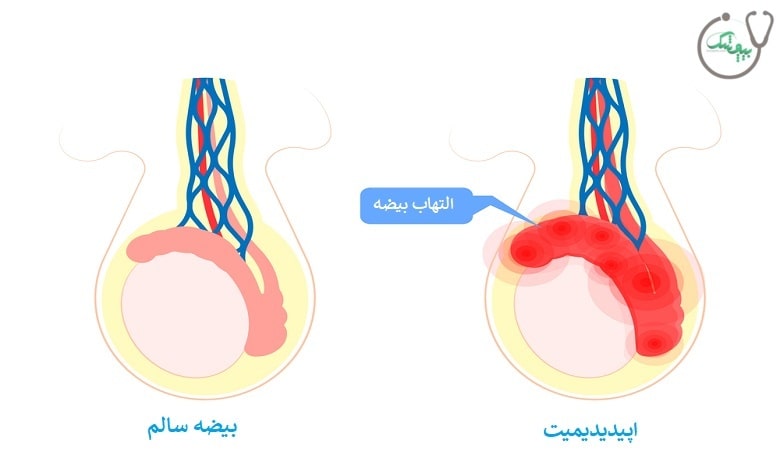 اپیدیدیمیت