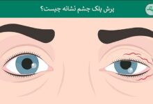 پرش پلک