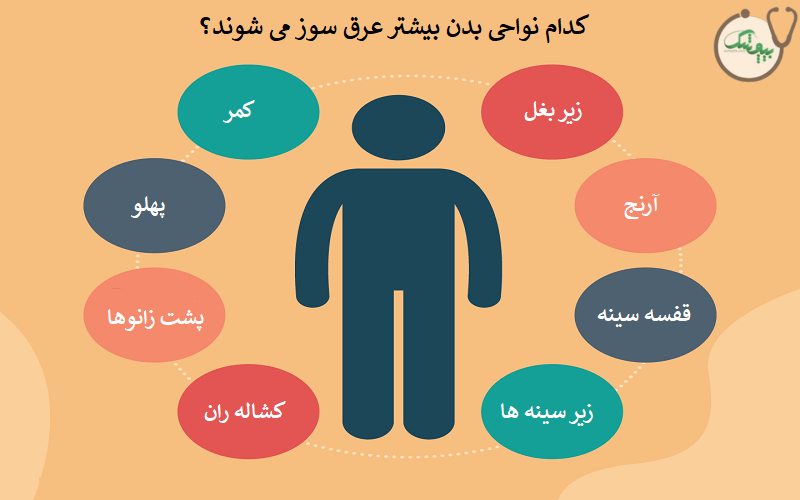نواحی که بیشتر عرق سوز می شوند