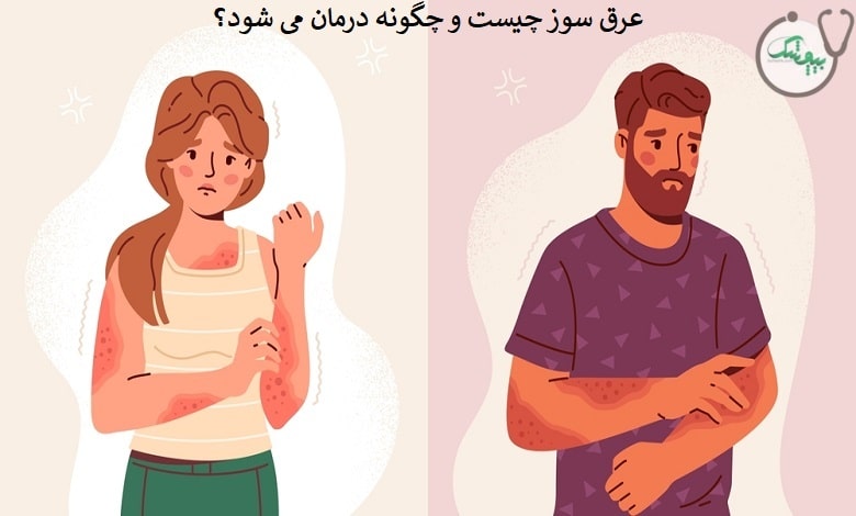 عرق سوز