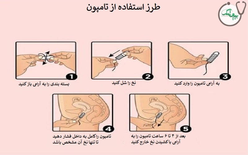 طرز استفاده از تامپون