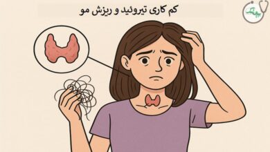 کم کاری تیروئید و ریزش مو