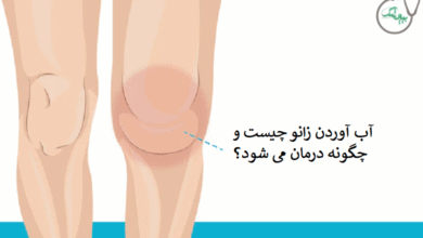آب آوردن زانو