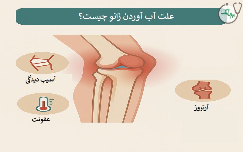 علت آب آوردن زانو