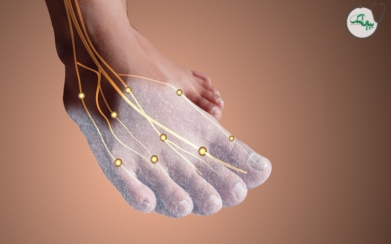 آسیب عصبی و سردی پا