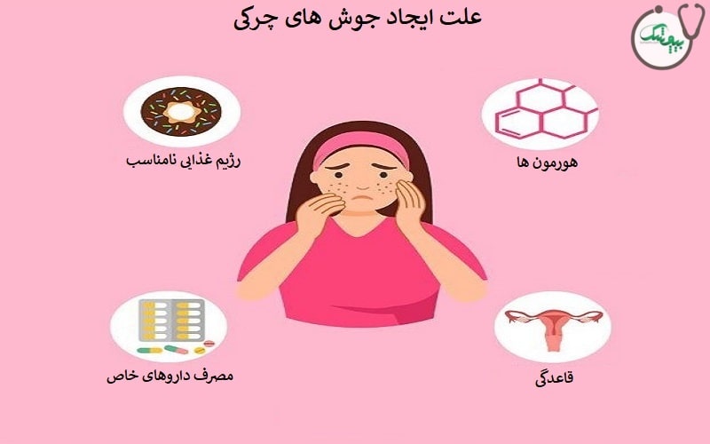 علت جوش چرکی بزرگ