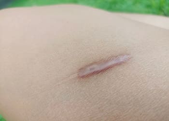 عکس اسکار برجسته