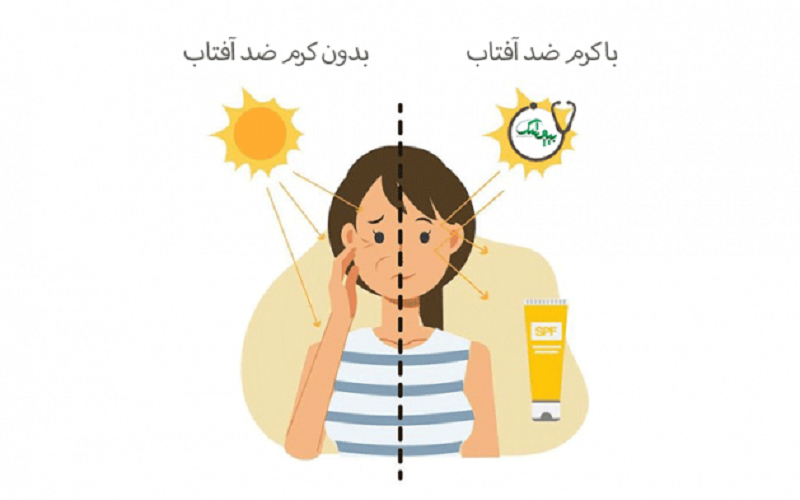 کاهش تاثیرات اشعه فرابنفش