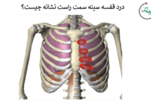 درد ققسه سینه سمت راست