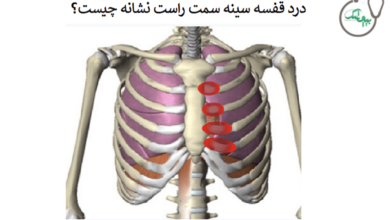 درد ققسه سینه سمت راست