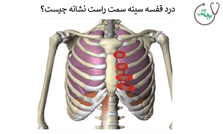 درد ققسه سینه سمت راست