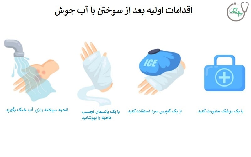 اقدامات اولیه بعد از سوختن با آب جوش