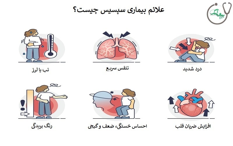 علائم سپسیس
