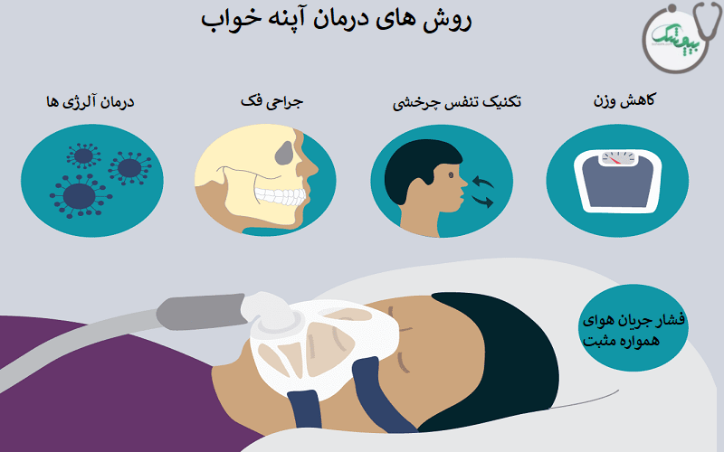 درمان قطعی آپنه خواب