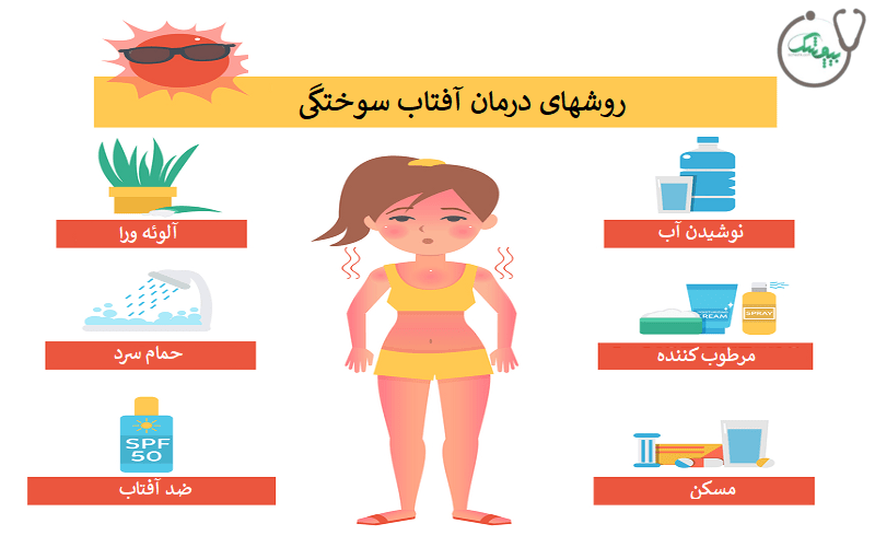 درمان آفتاب سوختگی