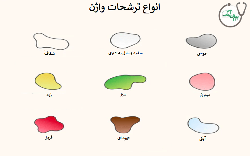 انواع ترشحات واژن