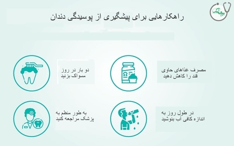 راهکارهایی برای جلوگیری از پوسیدگی دندان