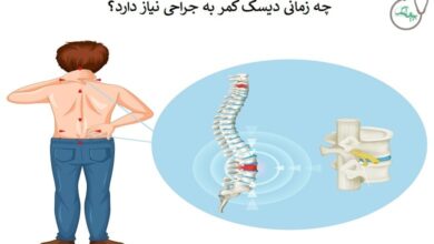 چه موقع دیسک کمر احتیاج به عمل دارد